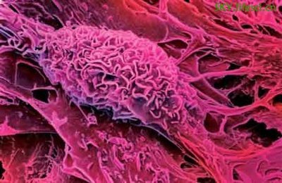 上海生科院发现间充质干细胞在应激过程中保护免疫细胞