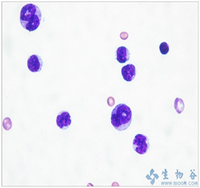 Cell：科学家开发出无毒副作用的新型抗白血病疗法