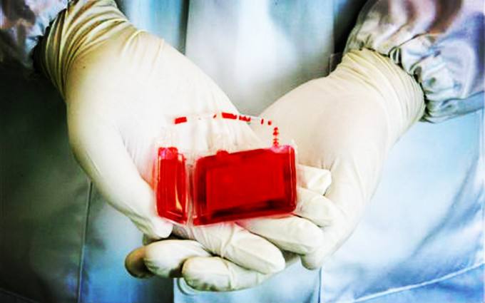 生命火种不容诋毁——科学对待脐带血储存价值